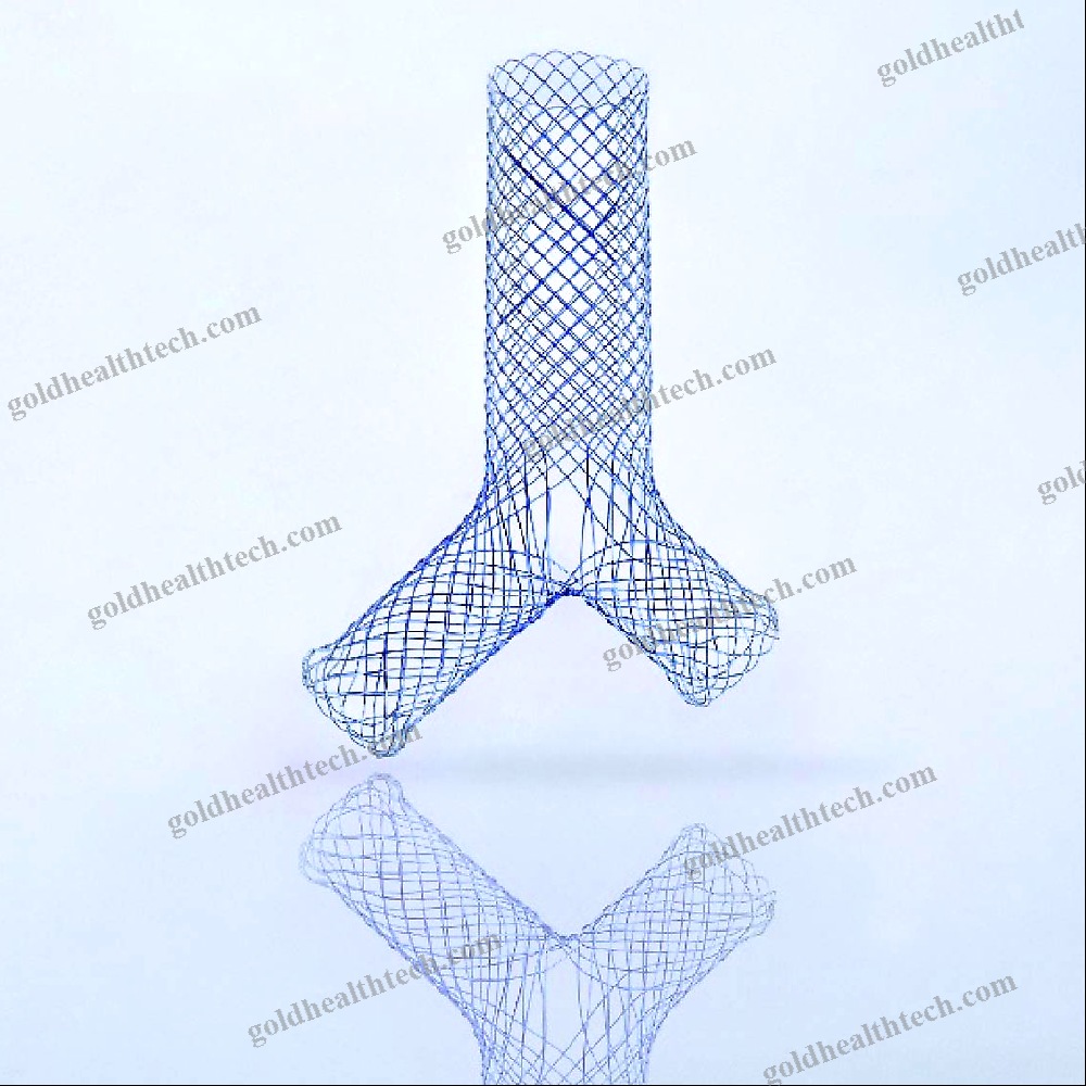Bronchial Stent
