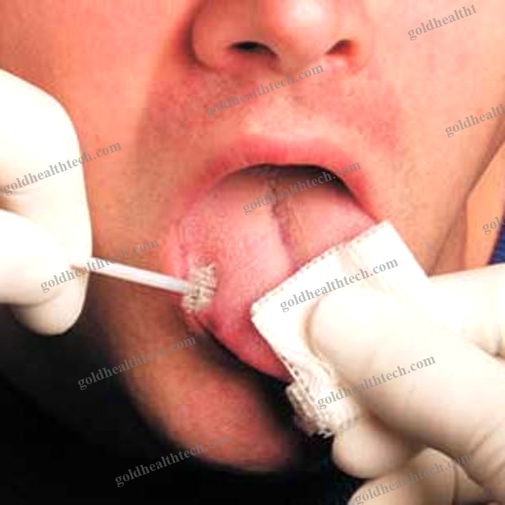Buccal Cytology Brush