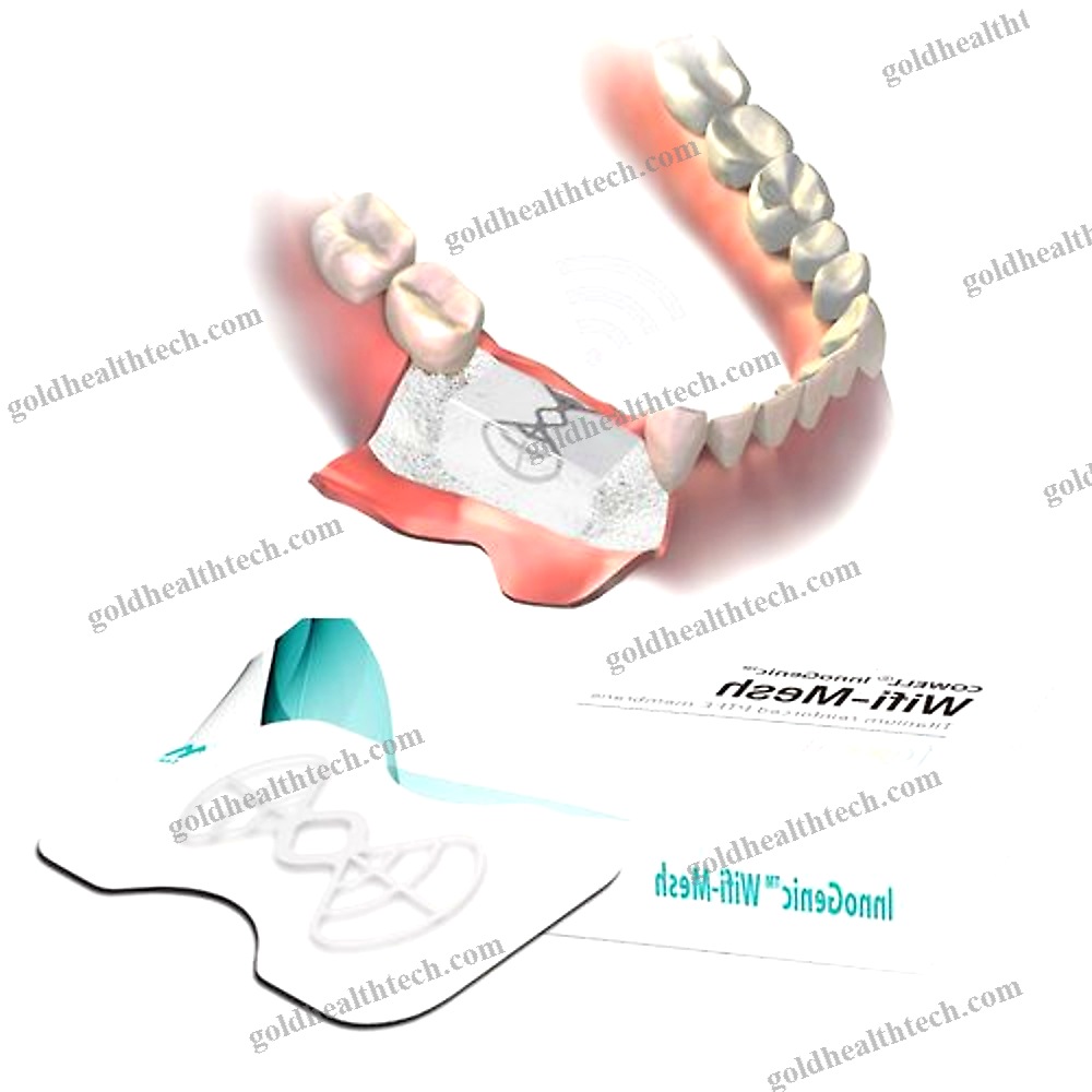 Buccal Tissue Matrix
