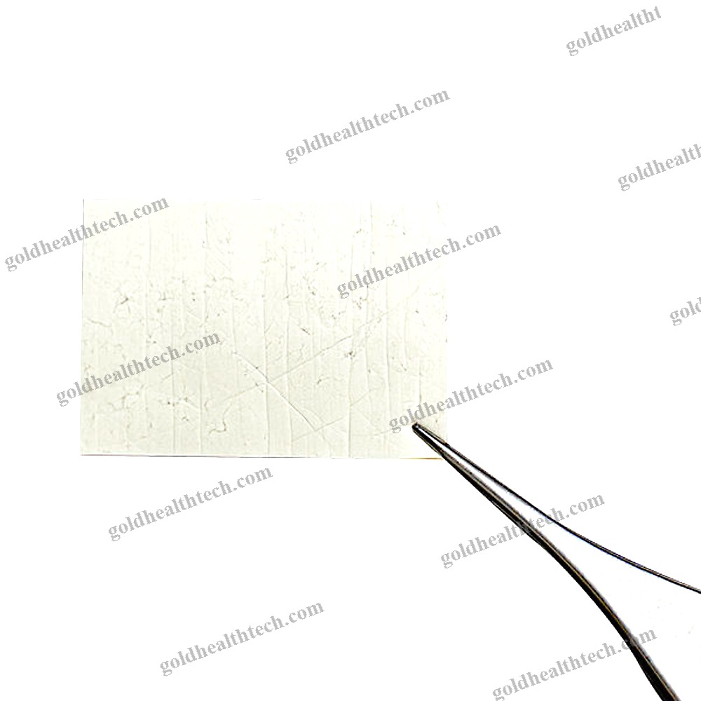 Buccal Tissue Matrix
