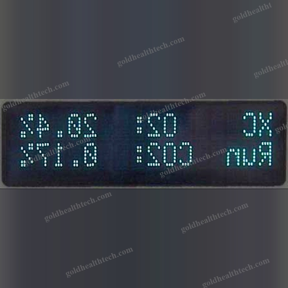 Calibration Analyzer 1