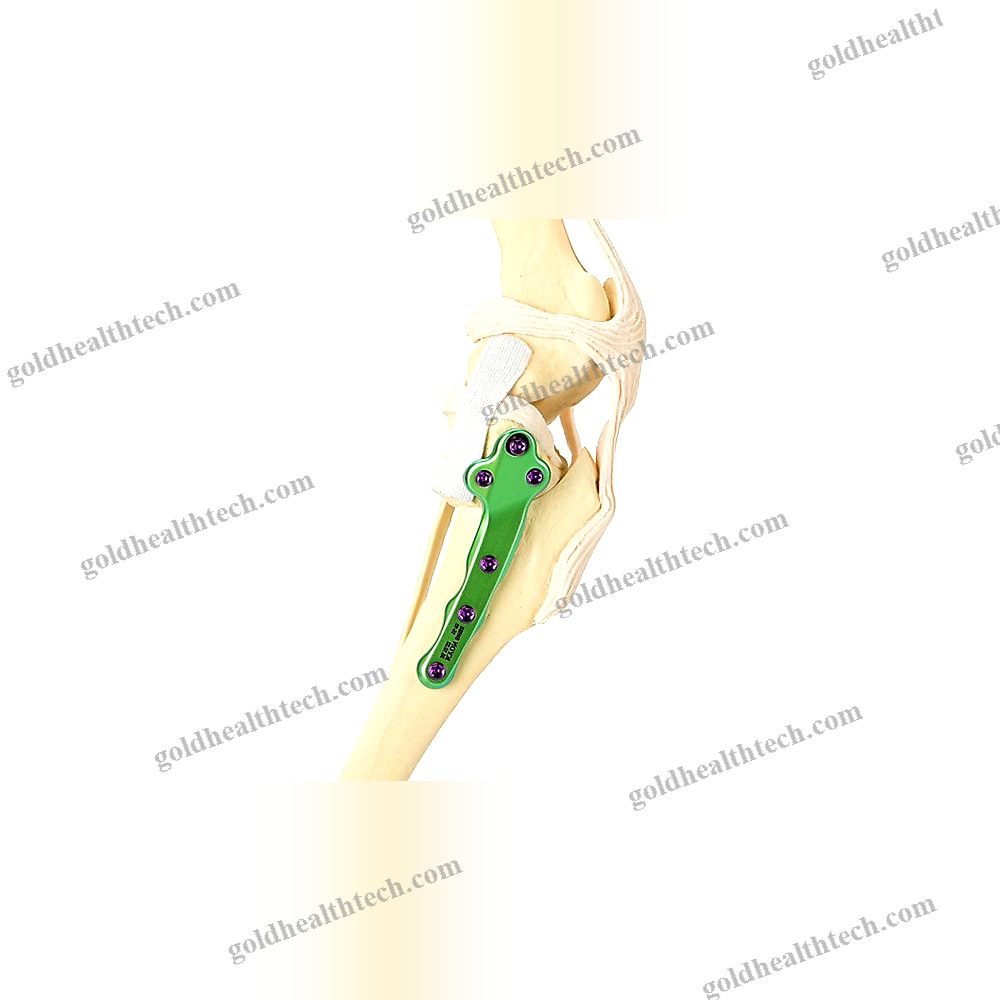 Canine Veterinary Bone Plate 1