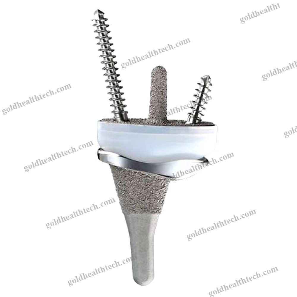 Cemented Wrist Prosthesis