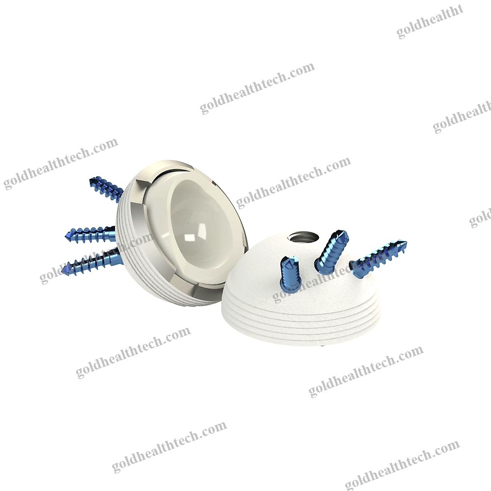 Cementless Acetabular Prosthesis