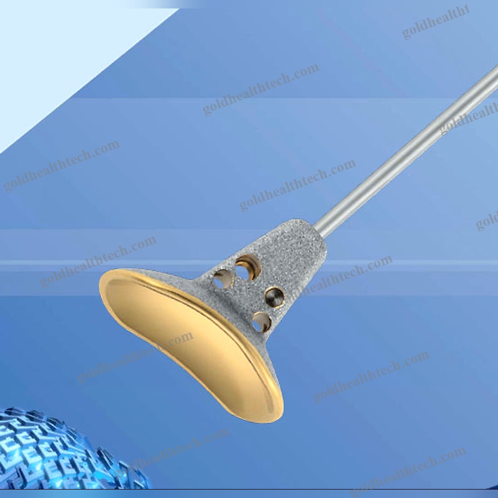 Cementless Distal Radius Prosthesis