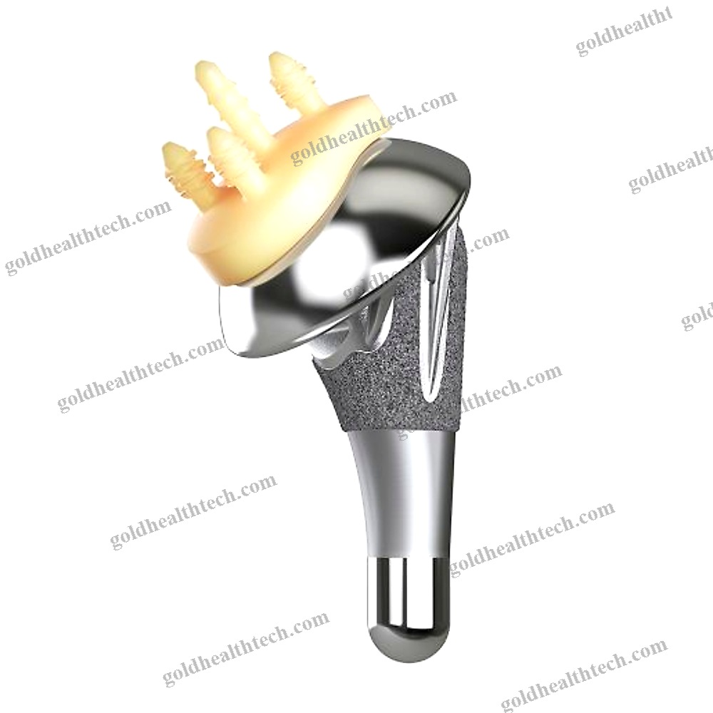 Cementless Shoulder Prosthesis