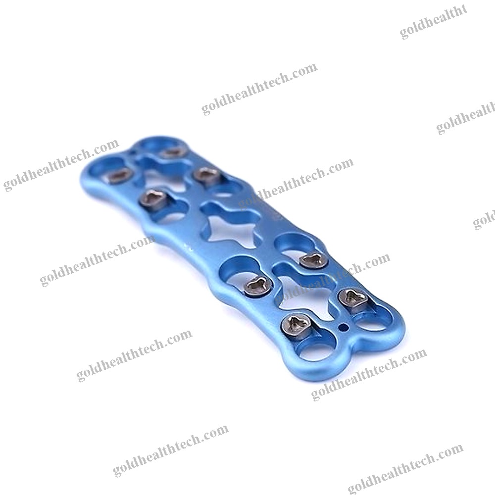 Cervical Arthrodesis Plate
