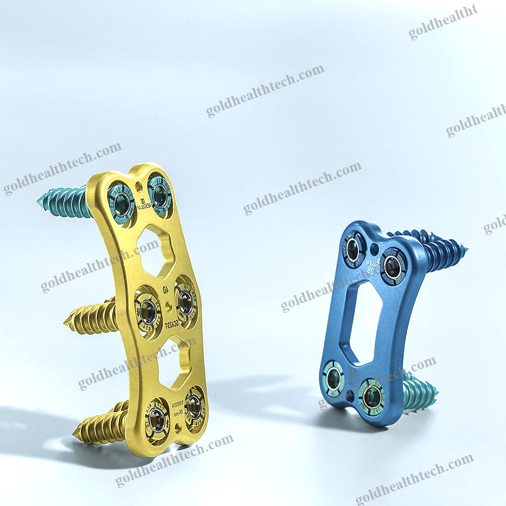 Cervical Arthrodesis Plate