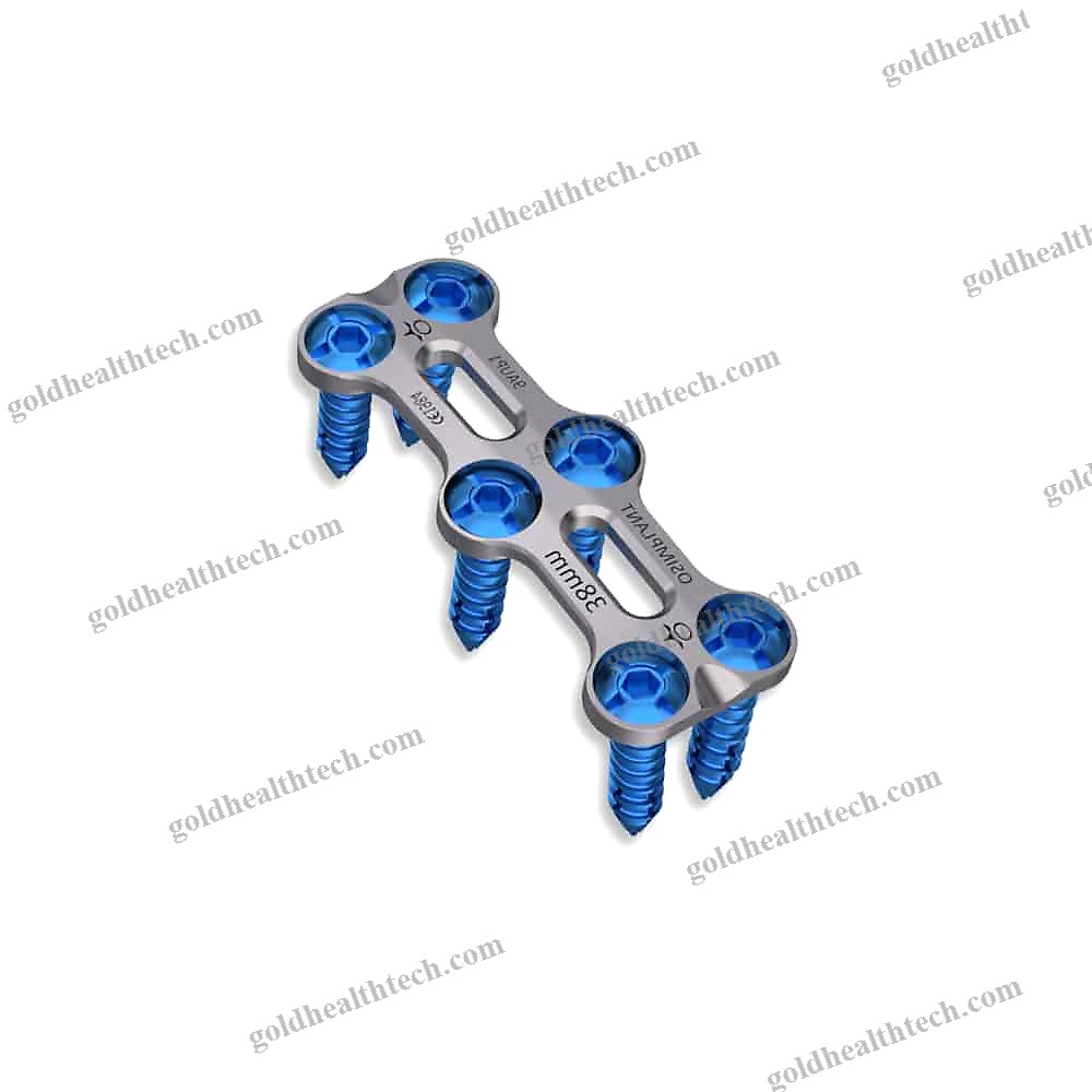 Cervical Arthrodesis Plate