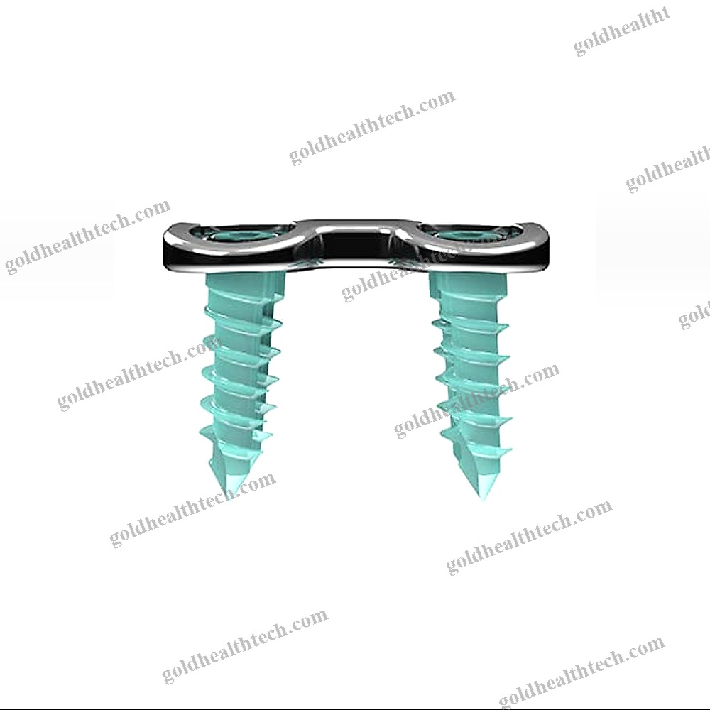 Cervical Arthrodesis Plate 1