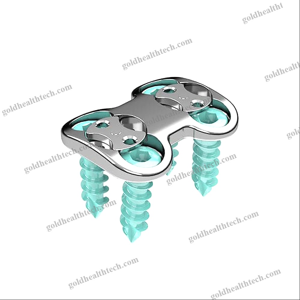 Cervical Arthrodesis Plate