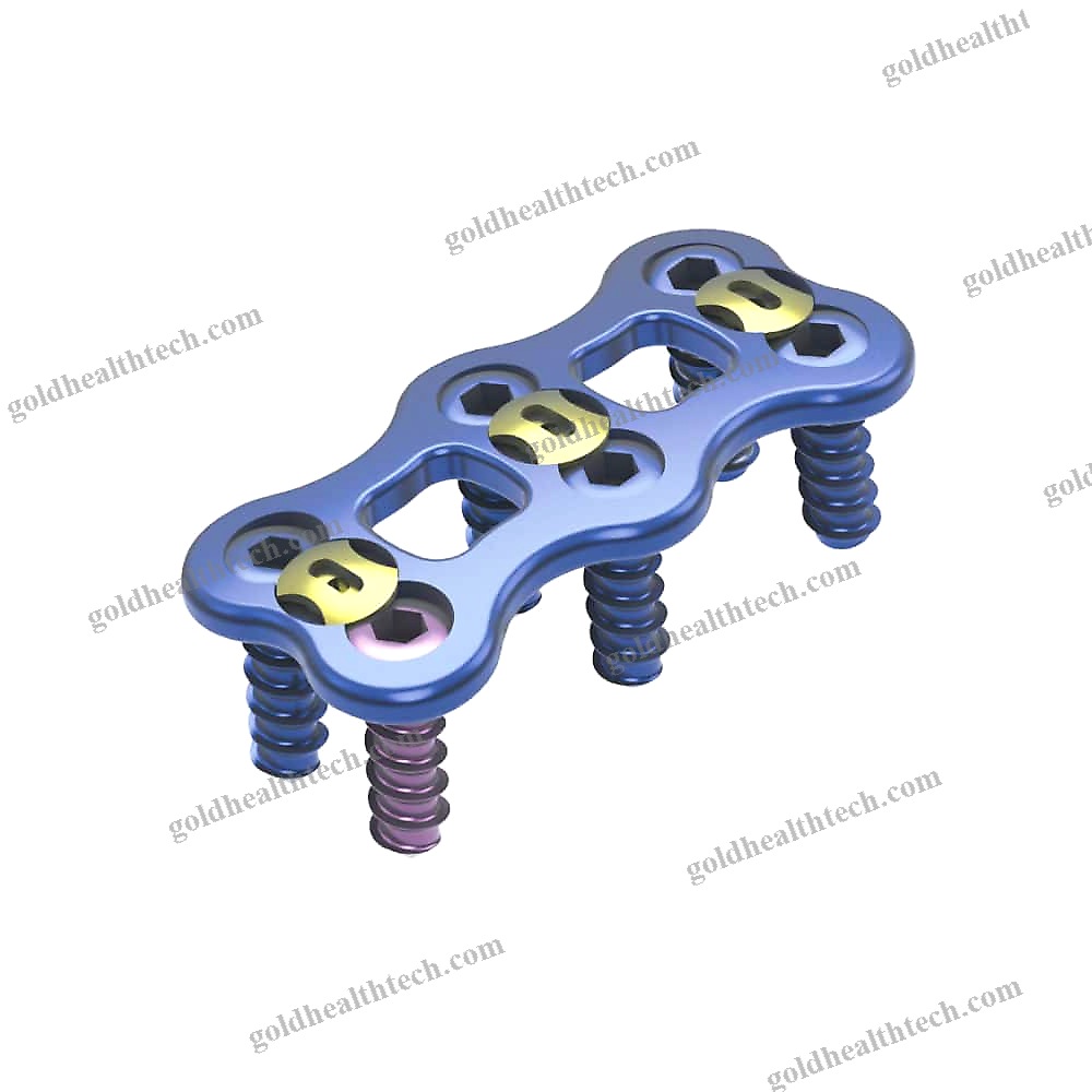 Cervical Arthrodesis Plate