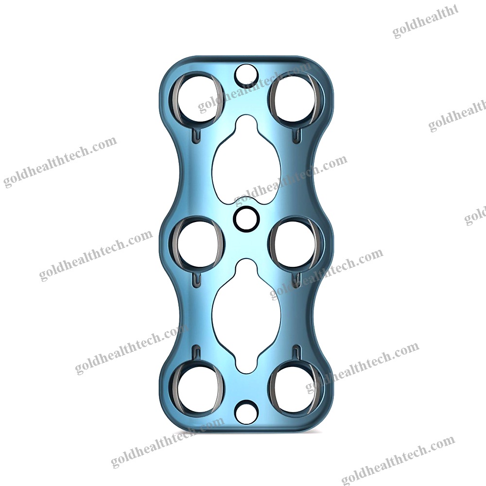 Cervical Arthrodesis Plate