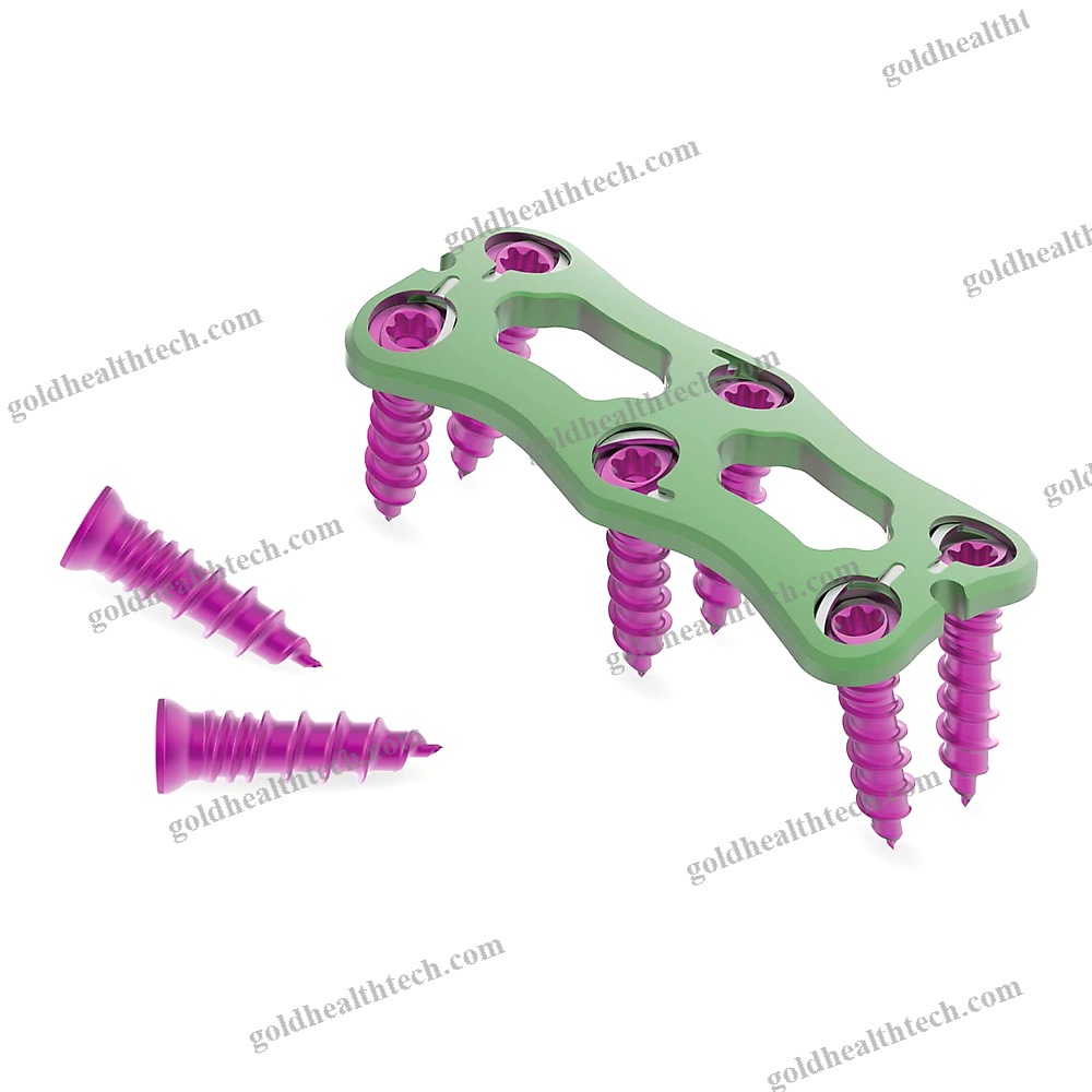 Cervical Arthrodesis Plate