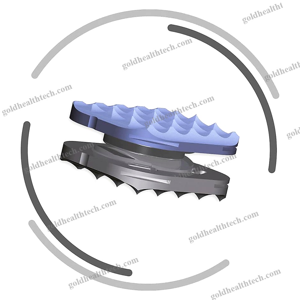 Cervical Disc Prosthesis