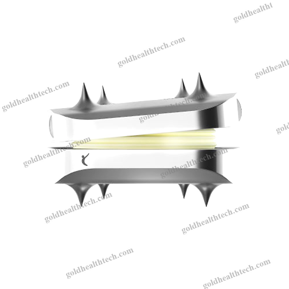 Cervical Disc Prosthesis