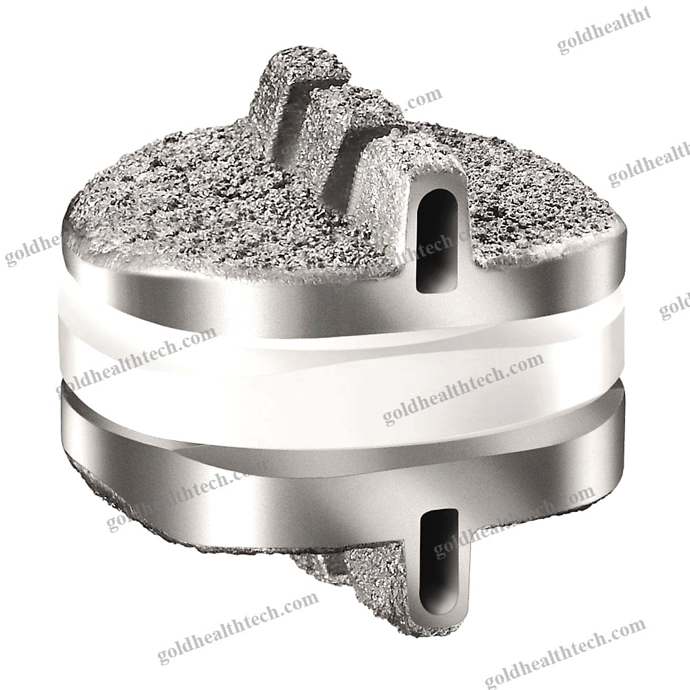 Cervical Disc Prosthesis