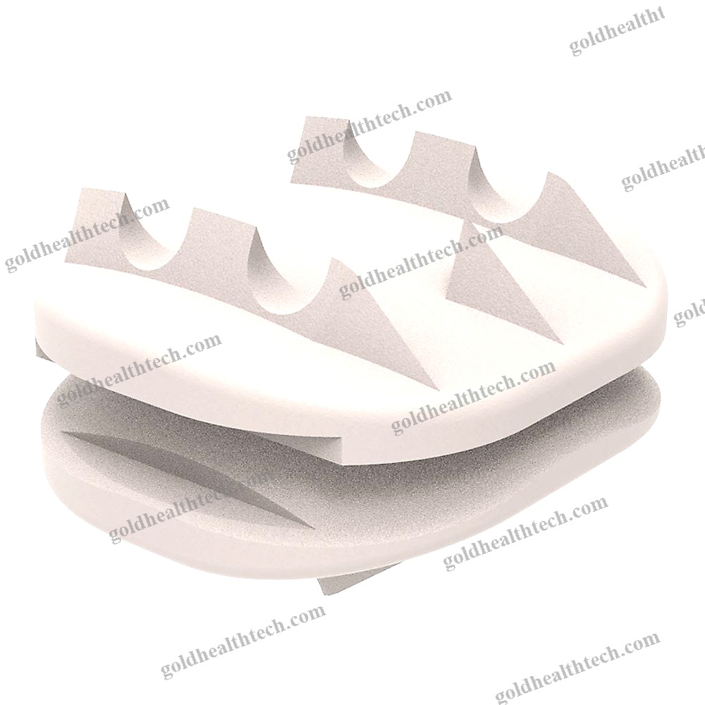 Cervical Disc Prosthesis