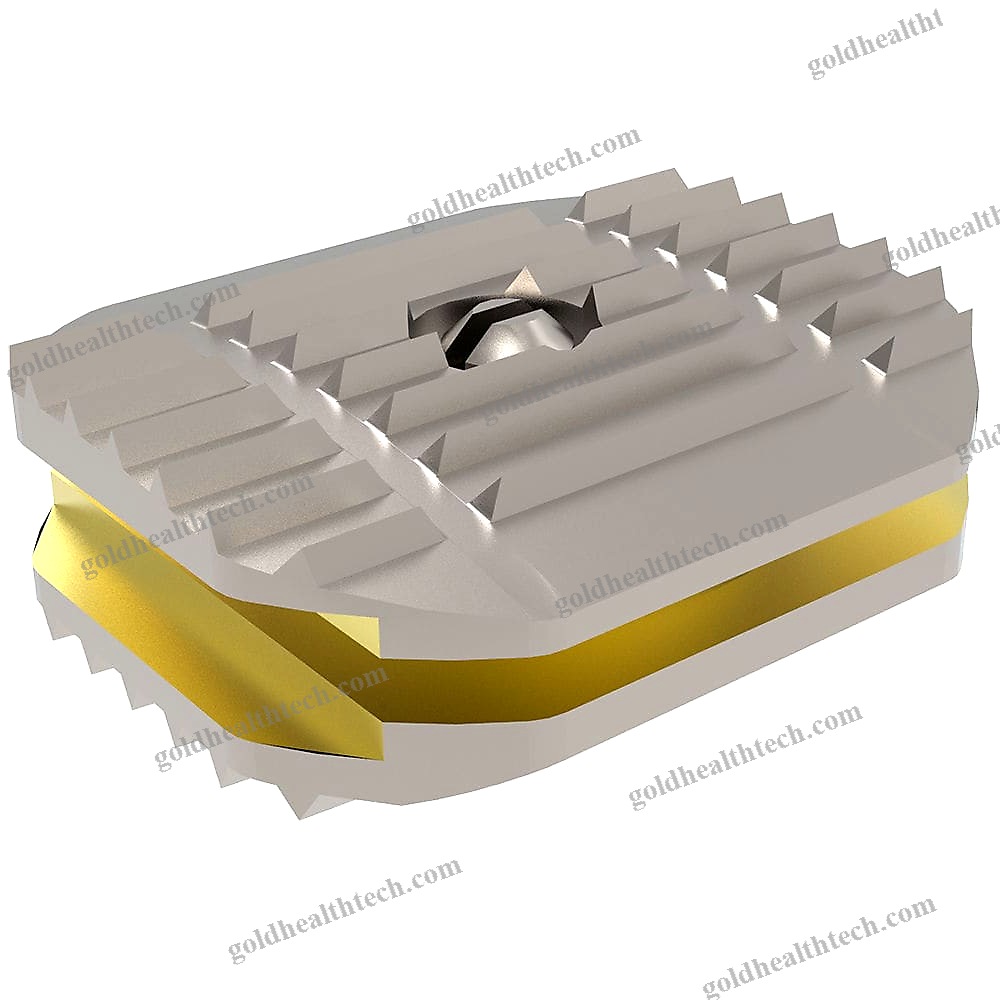 Cervical Disc Prosthesis