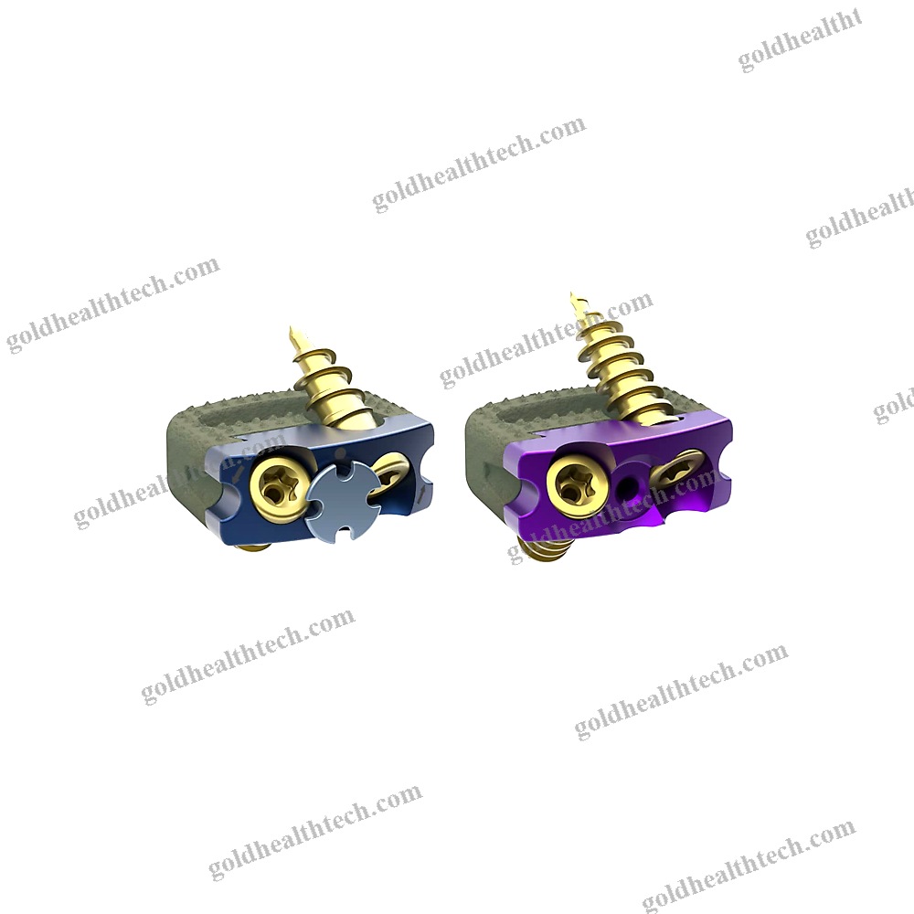Cervical Interbody Fusion Cage 1