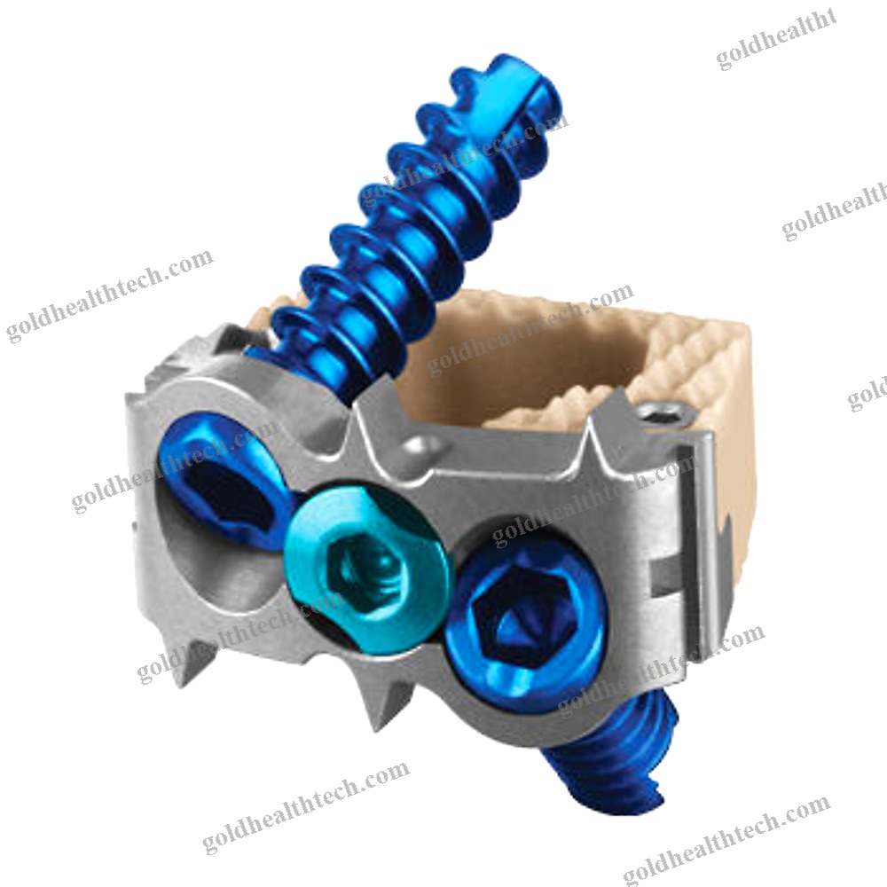 Cervical Interbody Fusion Cage