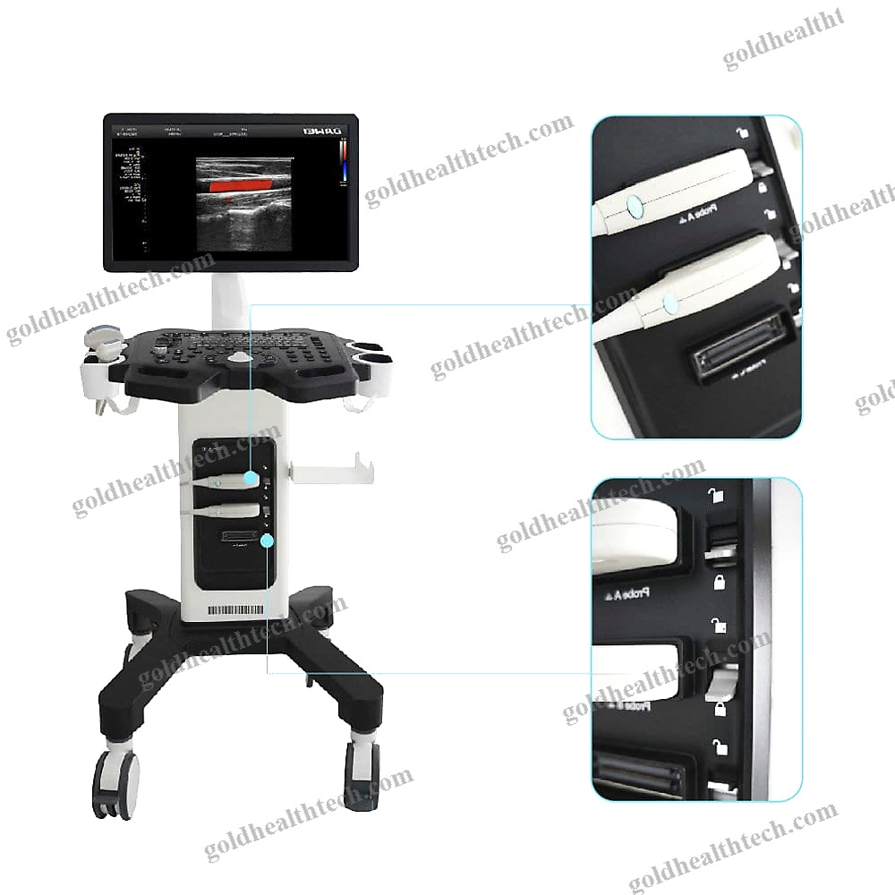 Color Doppler Ultrasound System 1