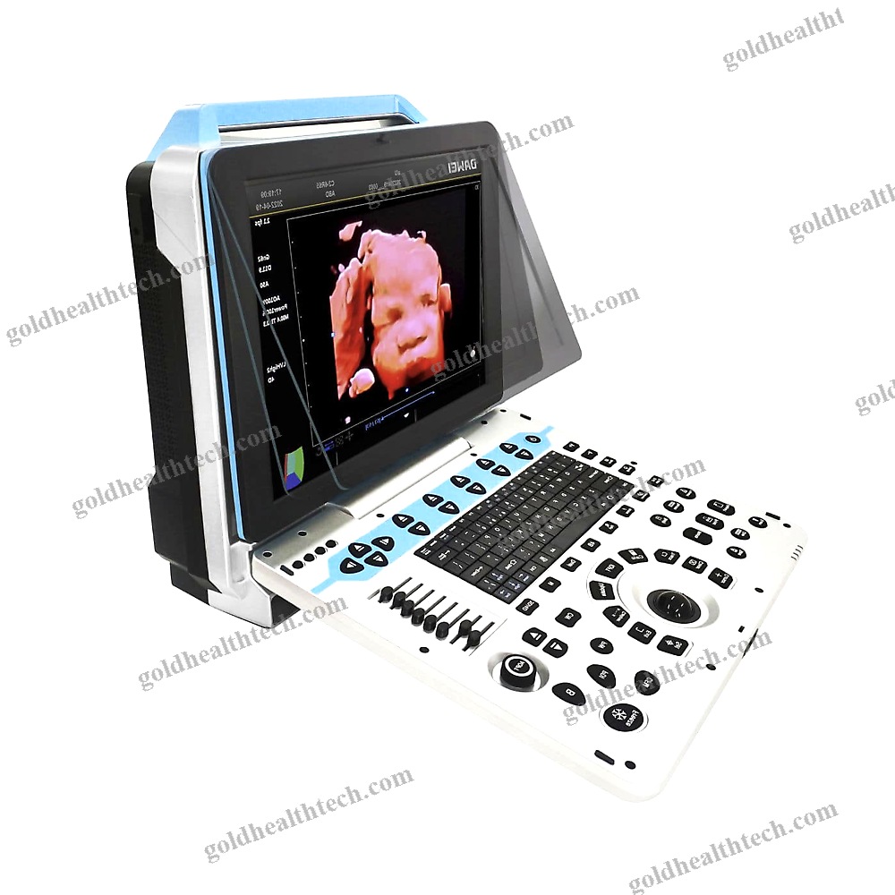 Color Doppler Ultrasound System