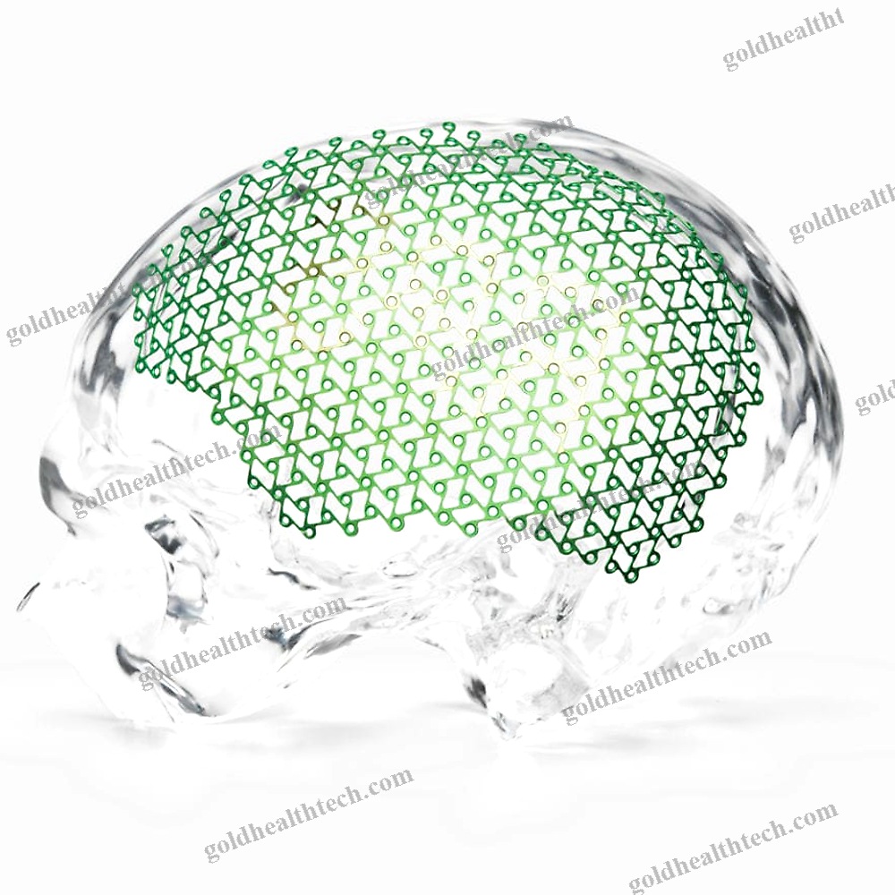 Cranial Implant
