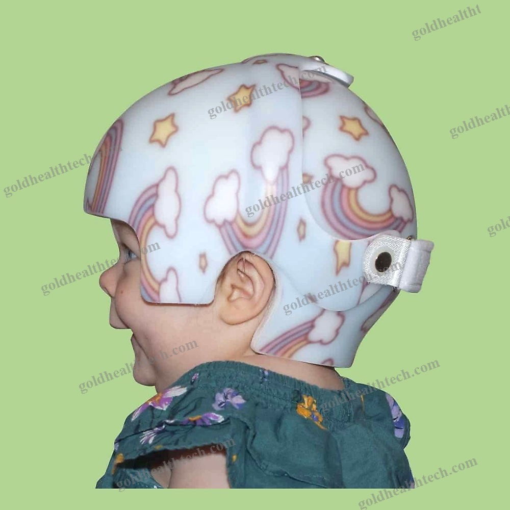 Cranial Orthosis