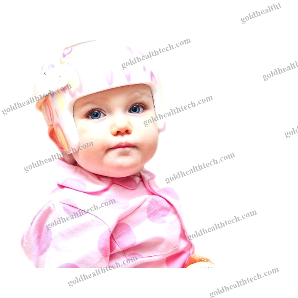 Cranial Orthosis