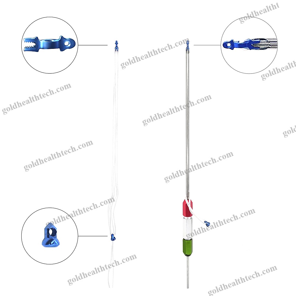 Cruciate Ligament Reconstruction Suture Button