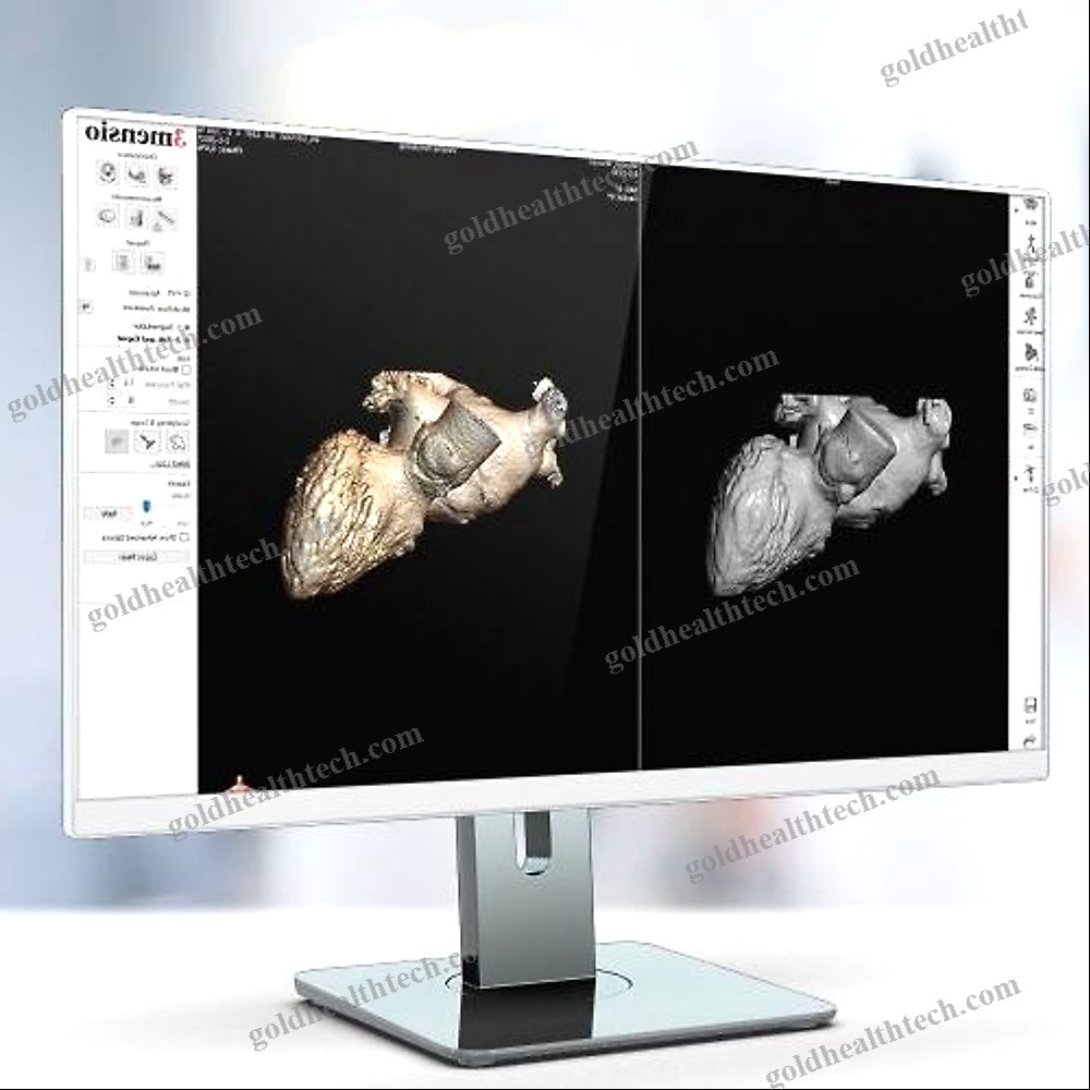 Ct Software