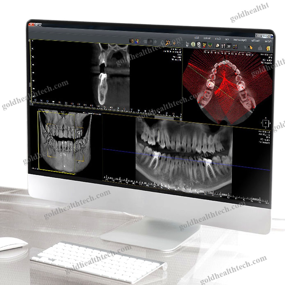 Dental Imaging Software