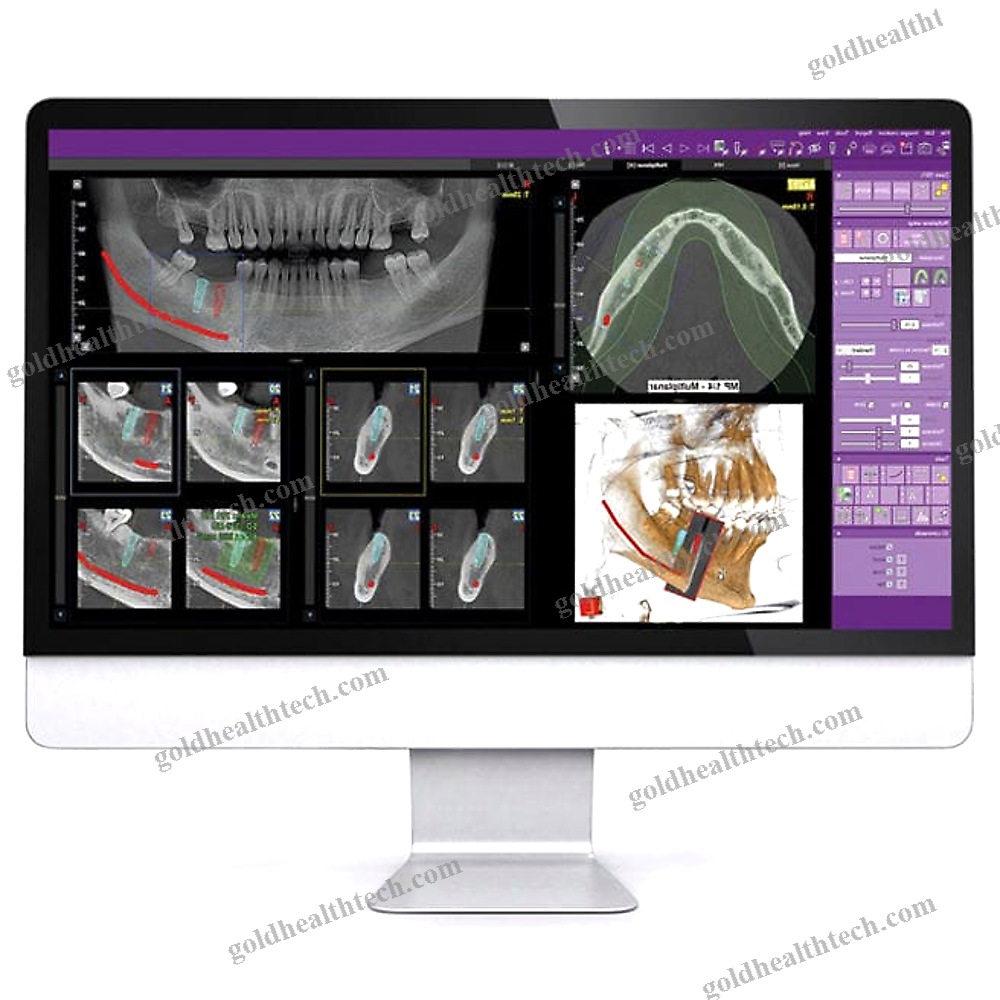 Dental Imaging Software