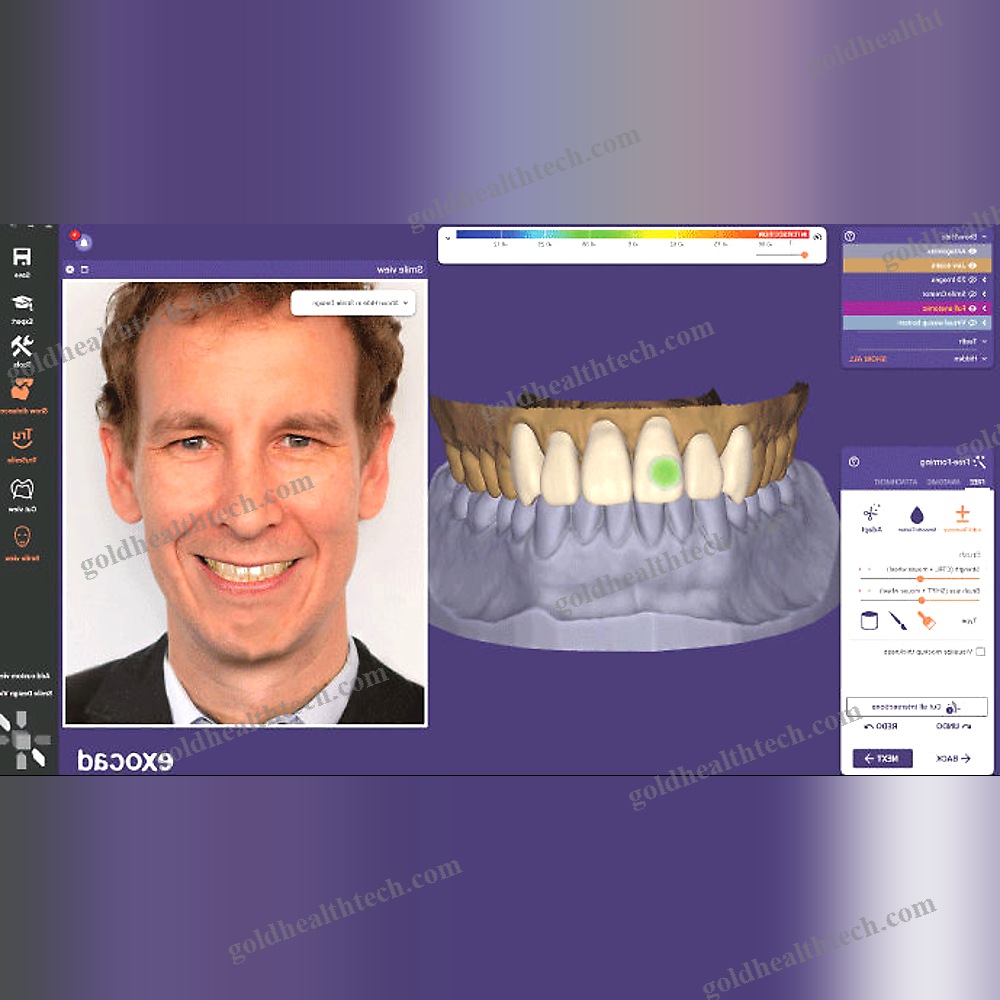 Dental Implantology Software 1