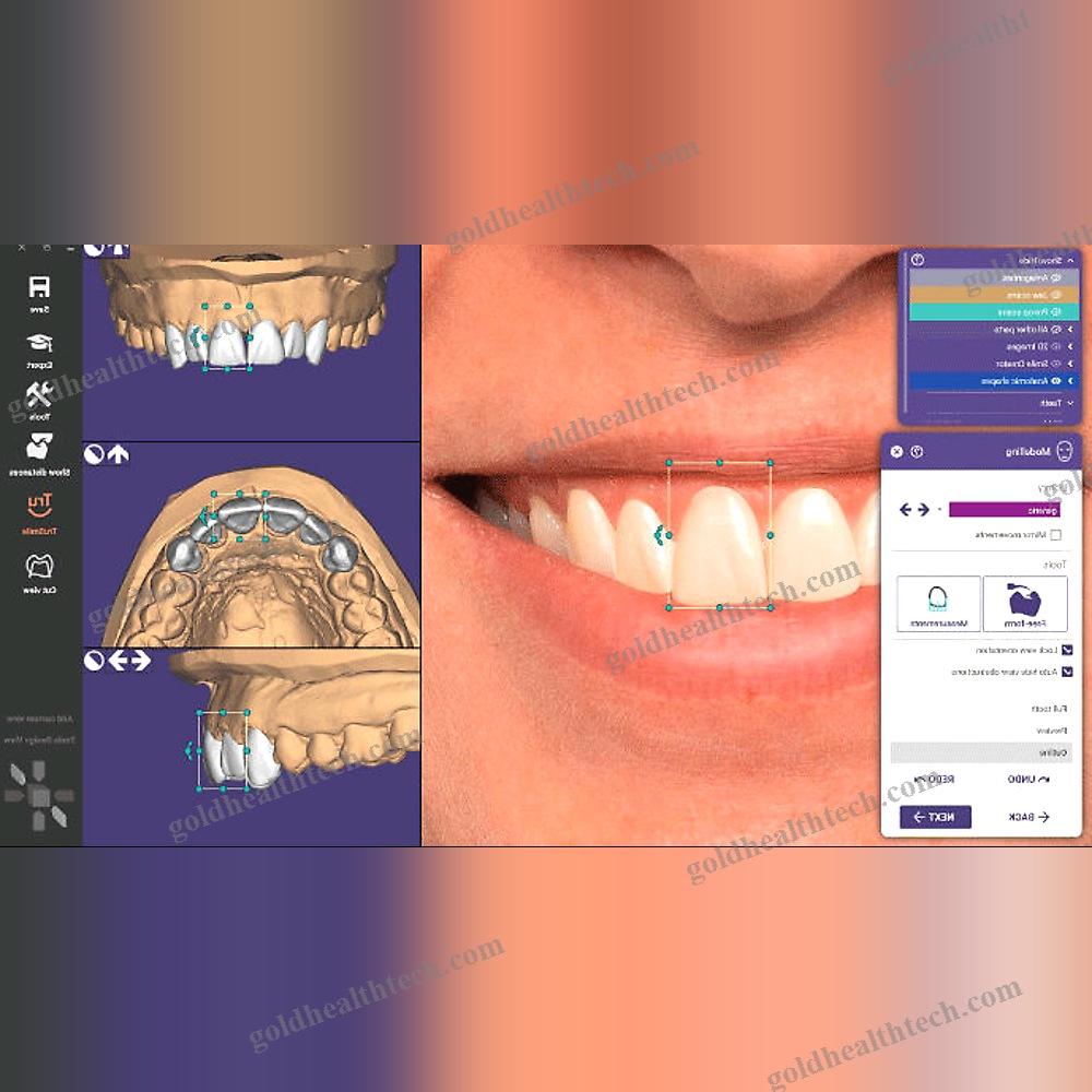Dental Implantology Software