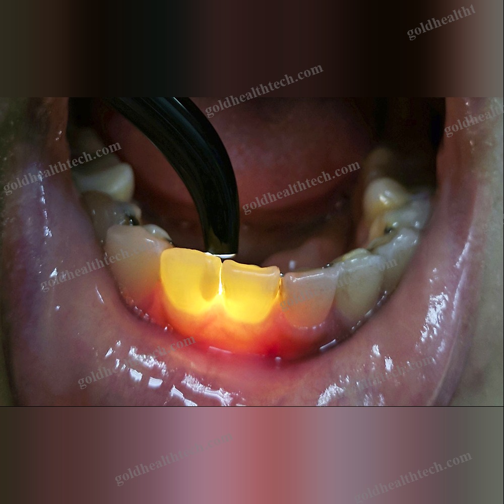 Dental Penlight 1