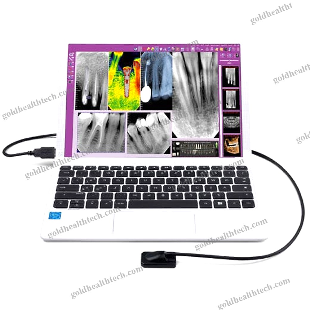Dental Radiography Intra-Oral Detector 1