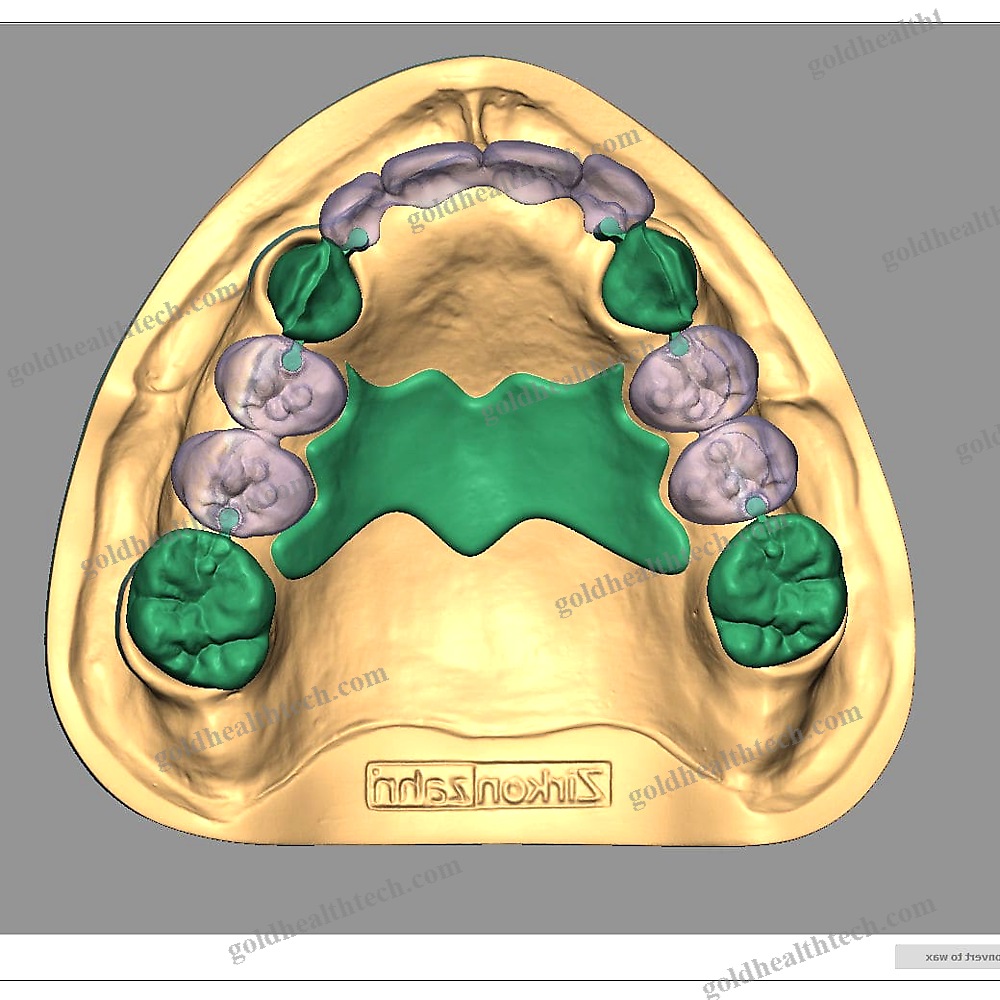 Dental Restoration Software