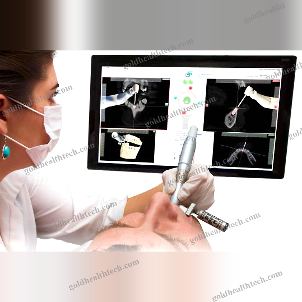 Dental Surgery Surgical Navigation System