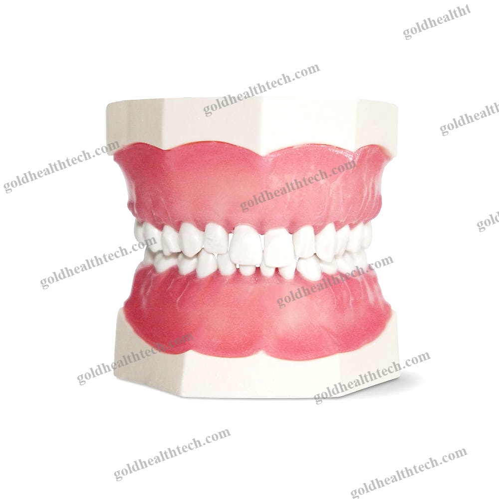 Denture Model