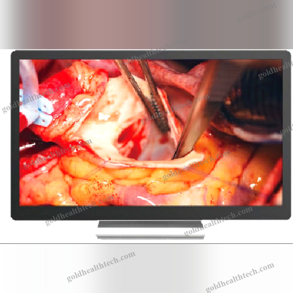 Diagnostic Display