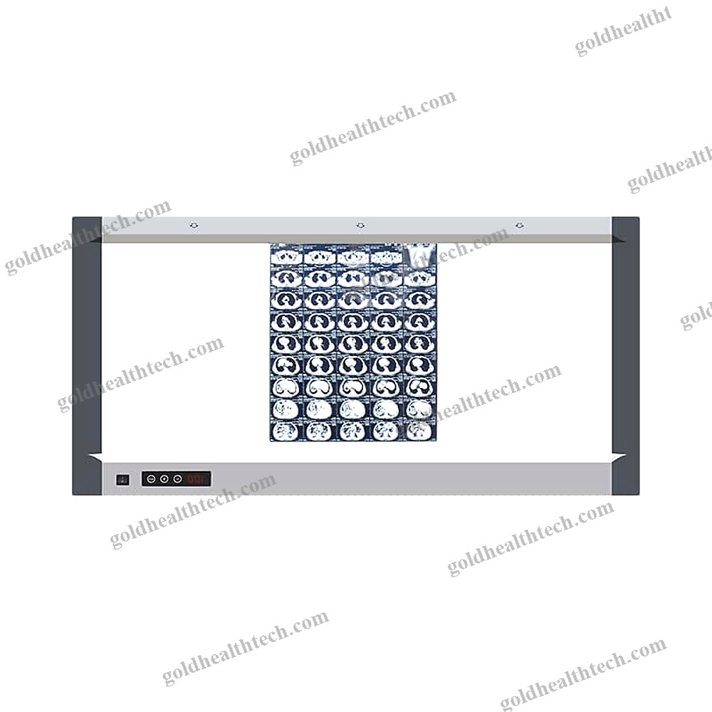 Digital X-Ray Film Viewer