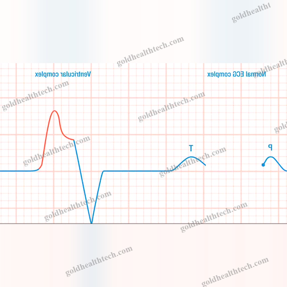Ecg Simulation Module