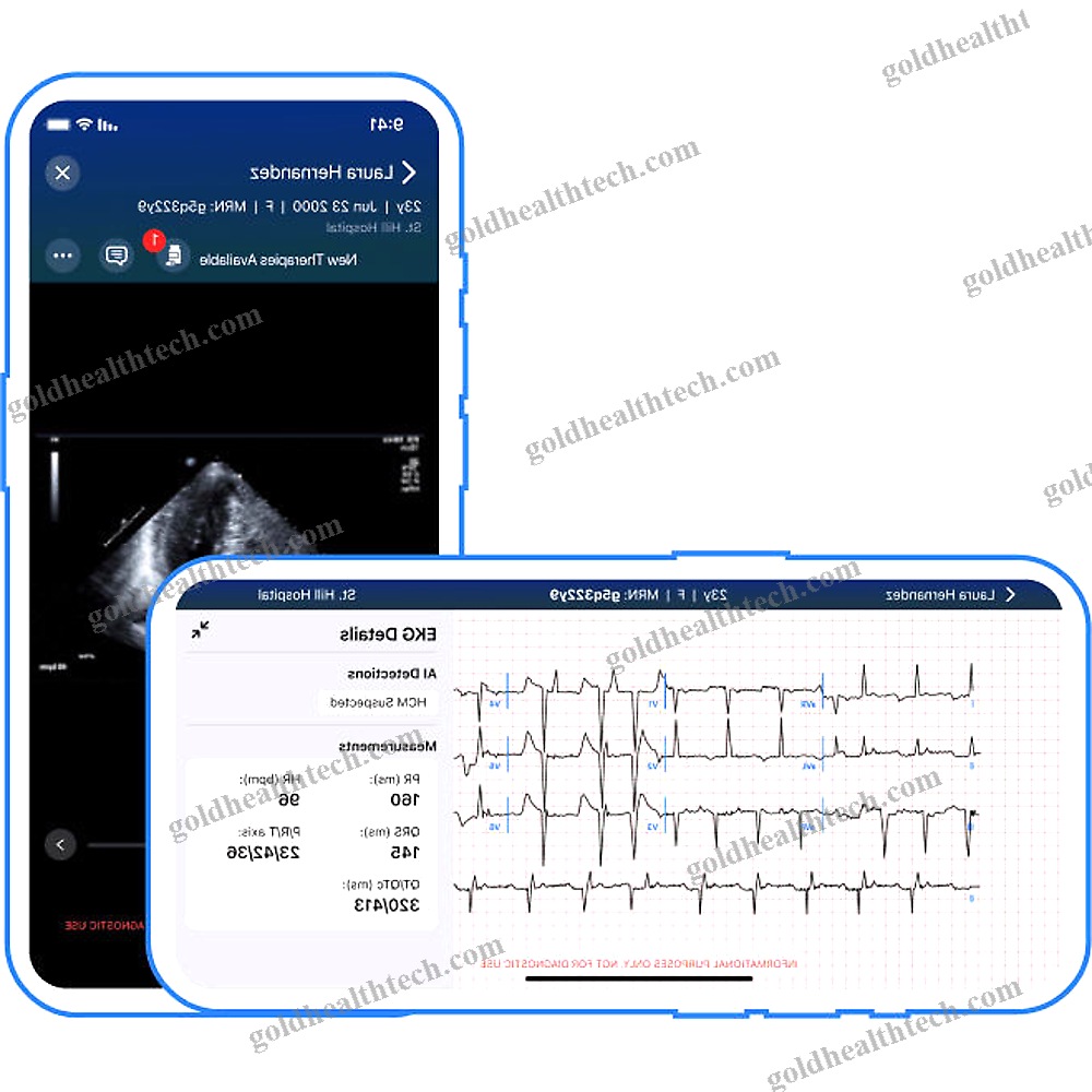 Echocardiography Mobile Application