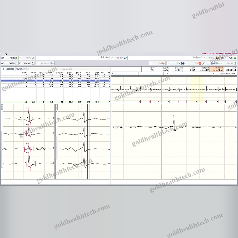 Eeg Software