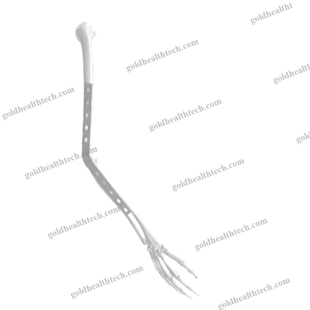 Elbow Arthrodesis Plate
