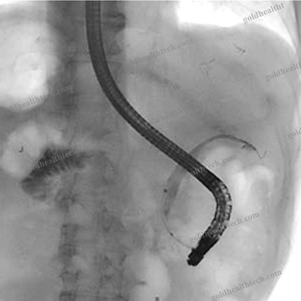 Endoscopic Retrograde Cholangiopancreatography Software