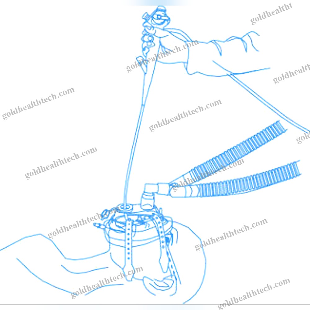Endoscopy Anesthesia Mask 1
