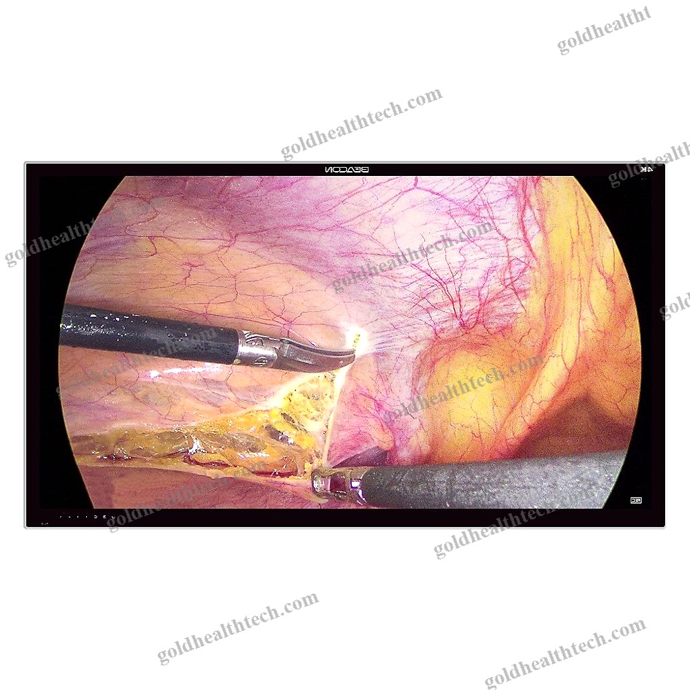 Endoscopy Display